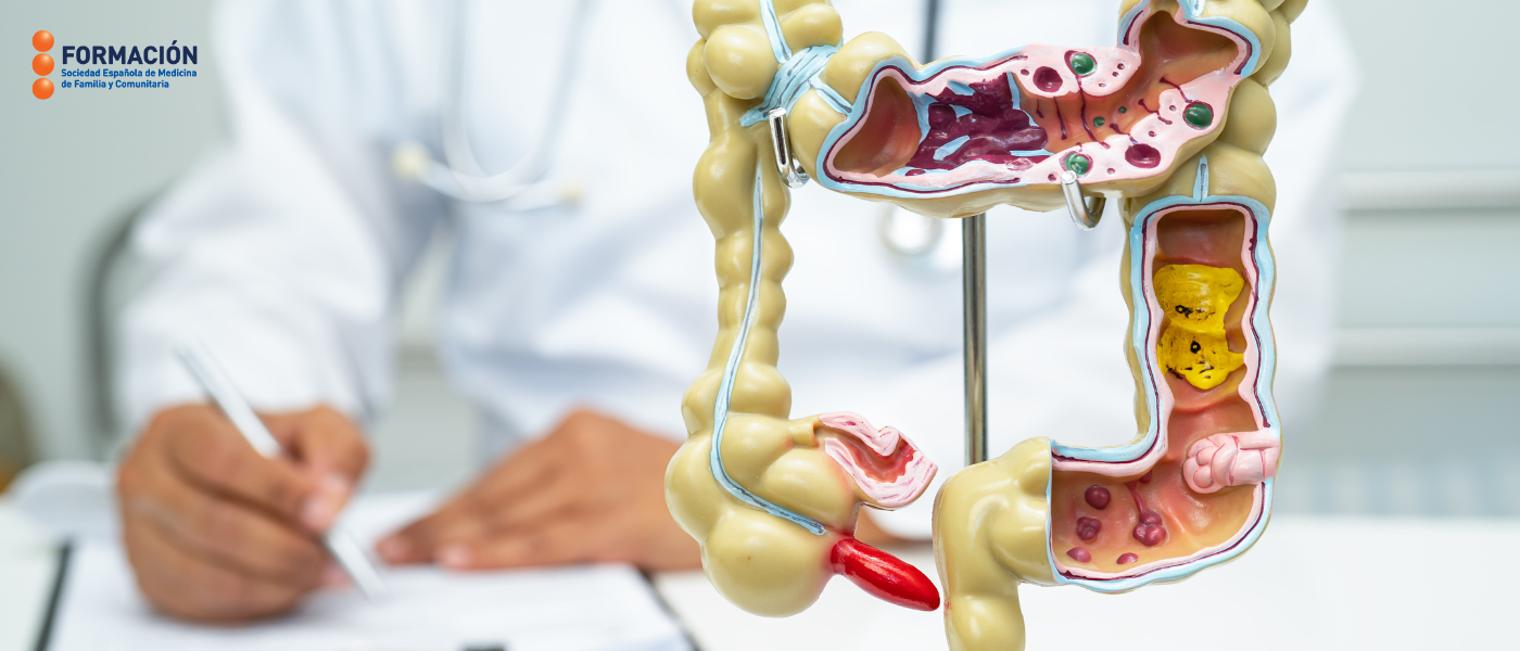 La Atención Primaria frente al cáncer colorrectal: fundamental en su detección y prevención